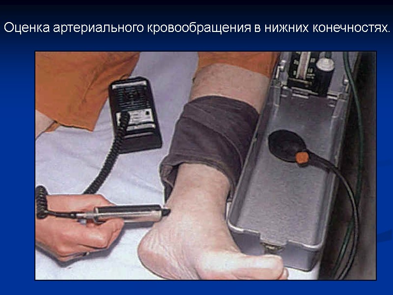 Оценка артериального кровообращения в нижних конечностях.